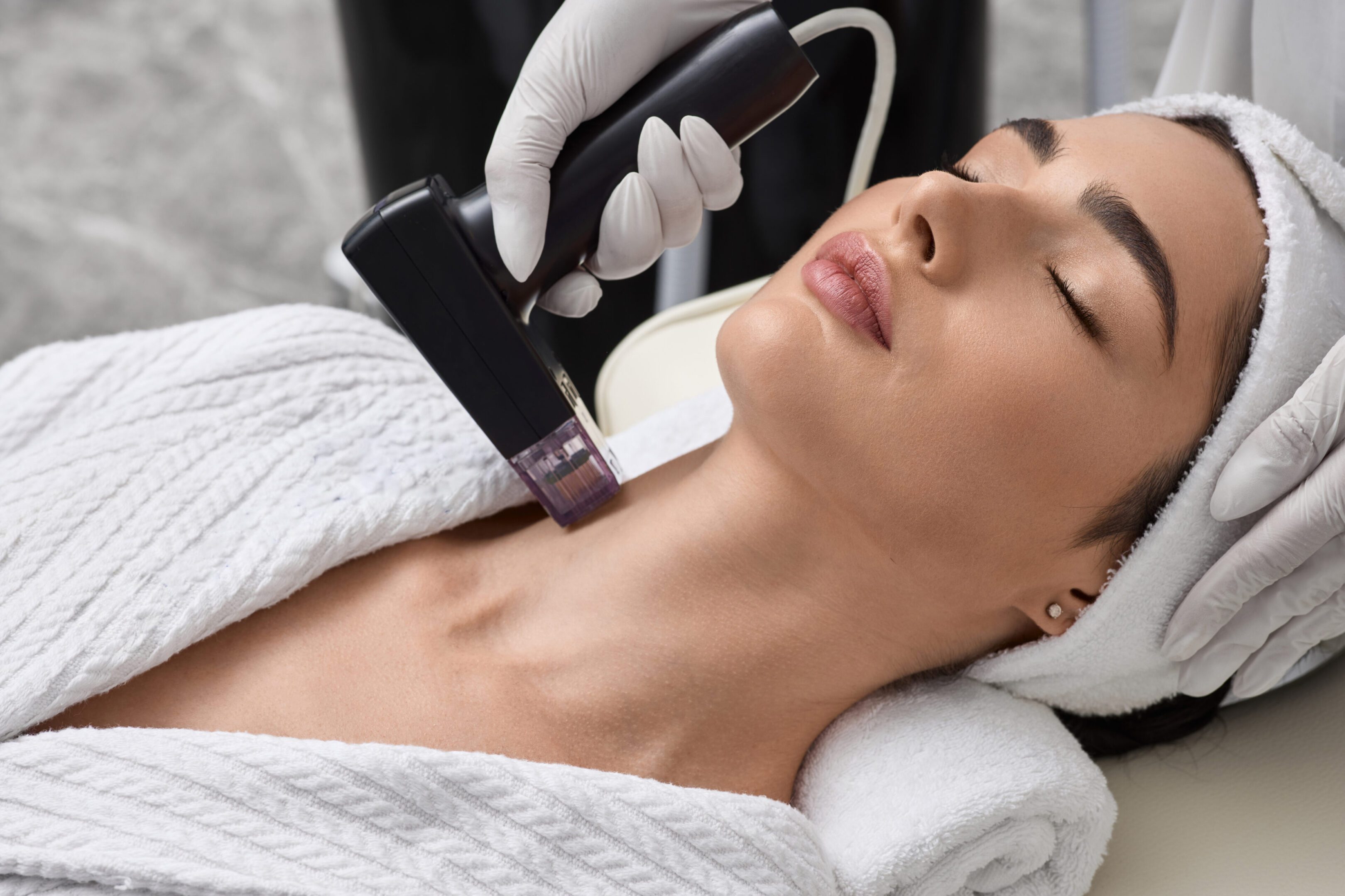 Facial treatment with laser device