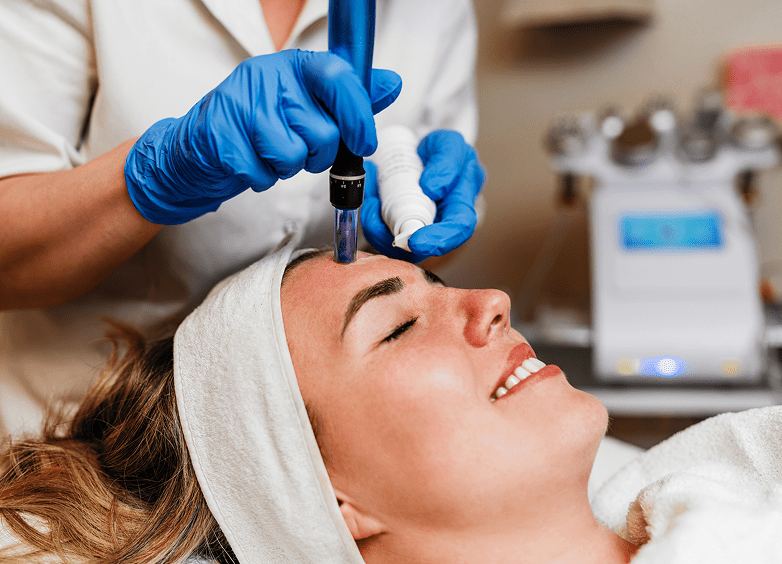 Microneedling therapy in progress